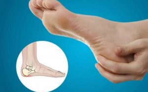 What is a heel spurs? What are its causes and symptoms? What is its treatment?