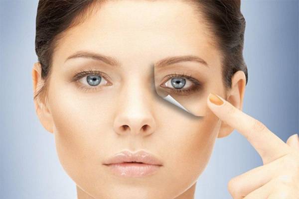 The leading causes of bruising and dark circles around the eyes and home remedies