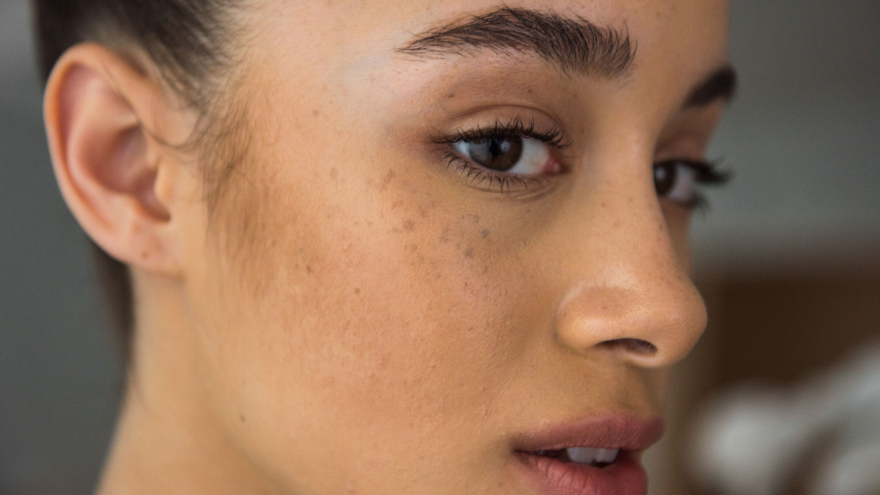 Causes of dark skin and its treatment methods