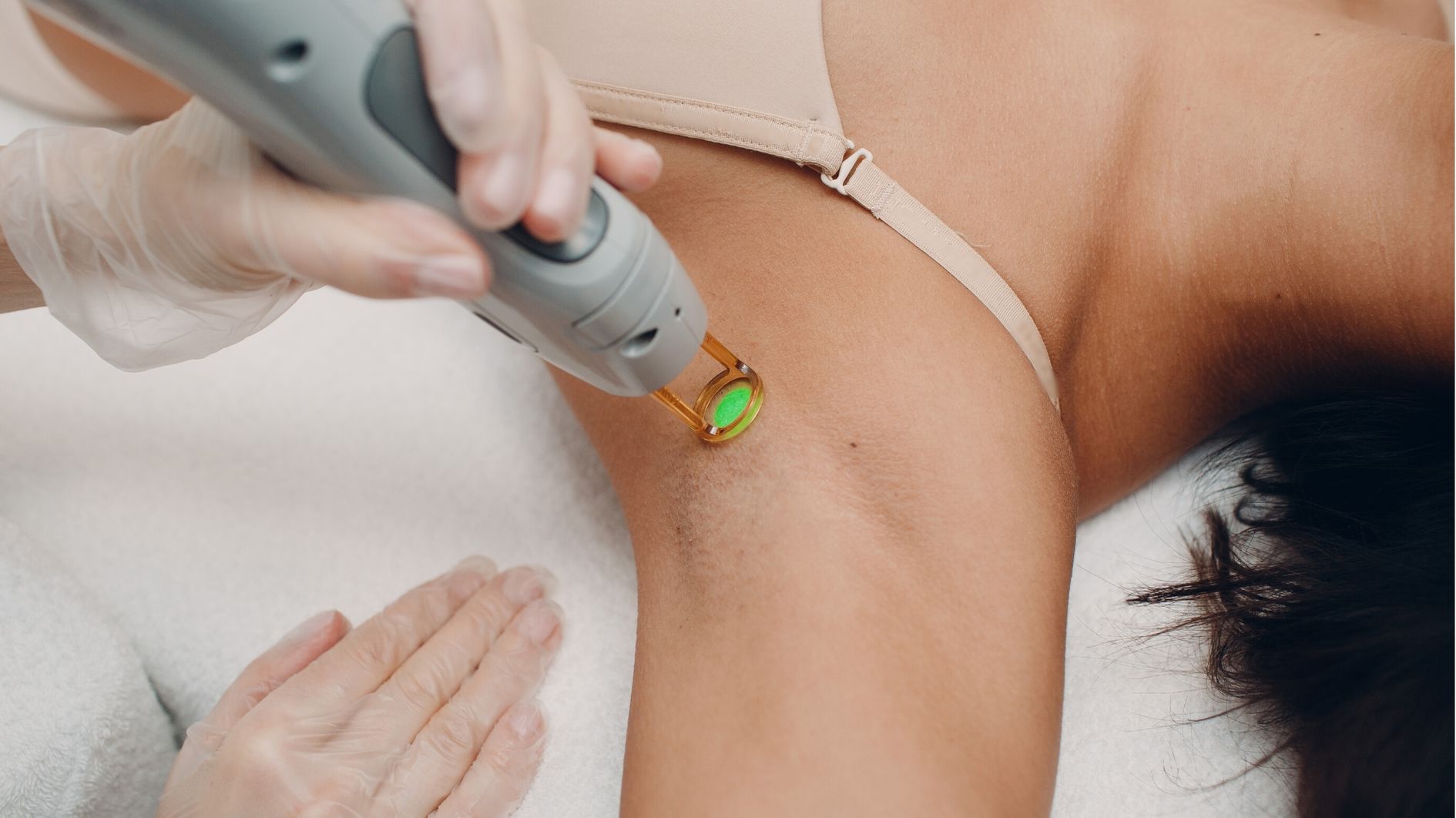 Comparison of laser hair removal with traditional methods