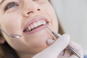 Everything about teeth scaling and its benefits and harms