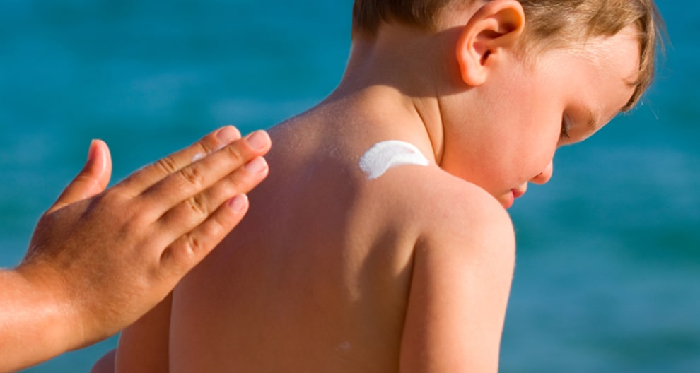 Misconceptions about sunscreen and sunburn