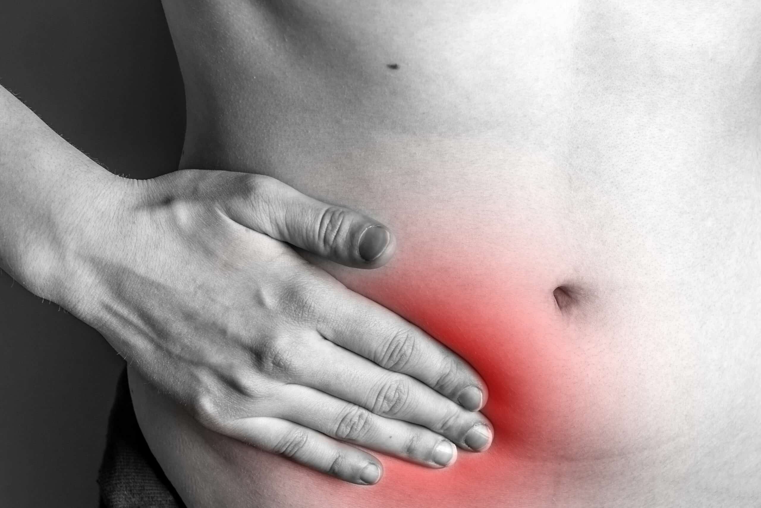 What causes an abdominal hernia, and how should it be treated?