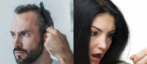 Cause and treatment of hair loss in women