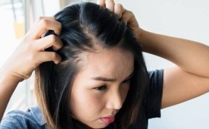 Cause and treatment of hair loss in women