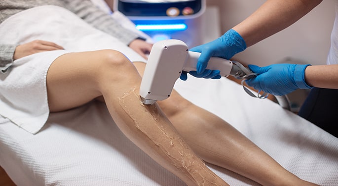 Important points before and after laser hair removal