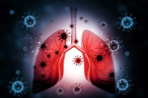 Causes, symptoms, and treatment of lung infection