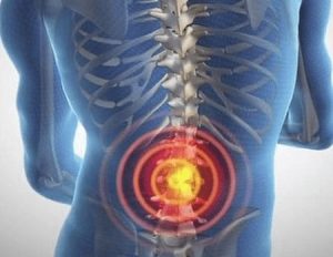 Everything about Spinal cord tumor