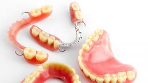 Everything you need to know about dentures