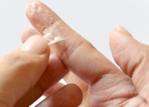 Immediate method of removing glue drop from the skin of the hand