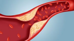 Everything we need to know about cholesterol?