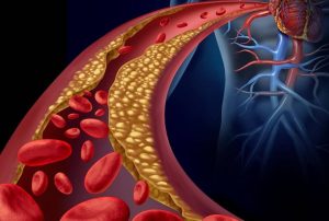 Everything we need to know about cholesterol?