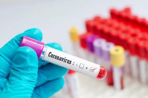 Introducing different types of corona tests; From PCR to antigen and antibody