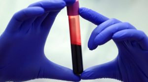 Types of blood tests to diagnose and prevent the disease