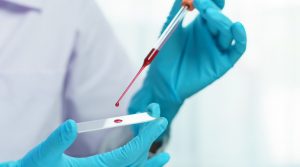 Types of blood tests to diagnose and prevent the disease