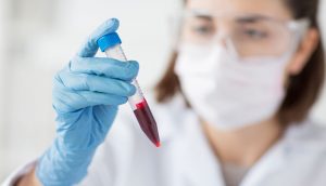 Types of blood tests to diagnose and prevent the disease