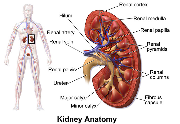 Kidney stones and methods of prevention and treatment