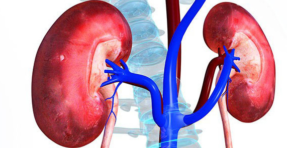 Kidney stones and methods of prevention and treatment