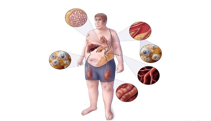 La causa y el tratamiento de los trastornos metabólicos