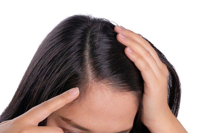 vitamin b hair loss - can it be treated?