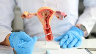 Una guía para mujeres sobre el síndrome de ovario poliquístico