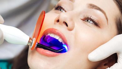 Come funziona il contouring di bellezza dentale?