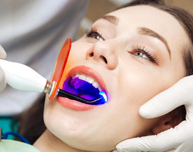 Como funciona o contorno de beleza dental?