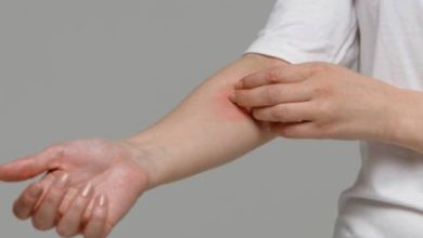 The causes and treatments of body itching
