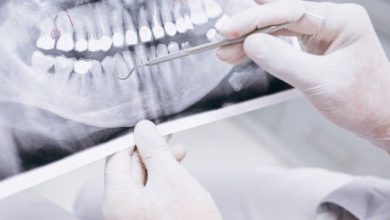 Comment soigner un traumatisme dentaire ?