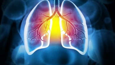 Fibrosi polmonare: cause, trattamento e prevenzione