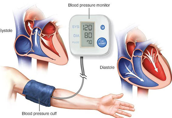 ¿Se puede curar la hipertensión naturalmente? + vídeo