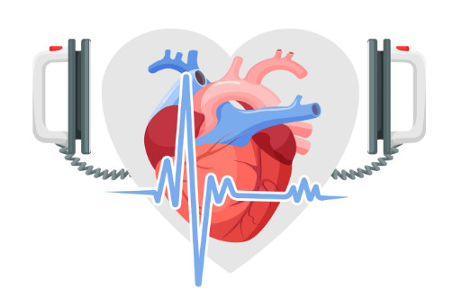 Risk factors for sudden cardiac arrest in athletes + video