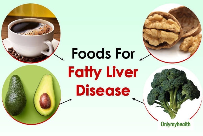what foods to eat to cure fatty liver?